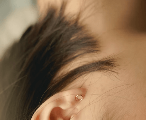 구안와사 초기증상 - 안면 비대칭