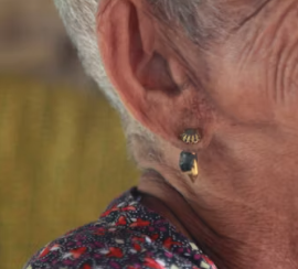 귀에서 삐소리가 나는 이유 이명 원인 대처법