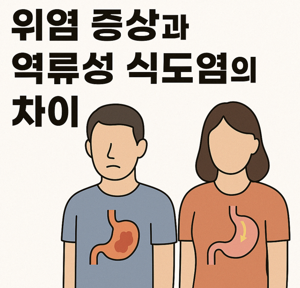 위염증상, 역류성식도염
