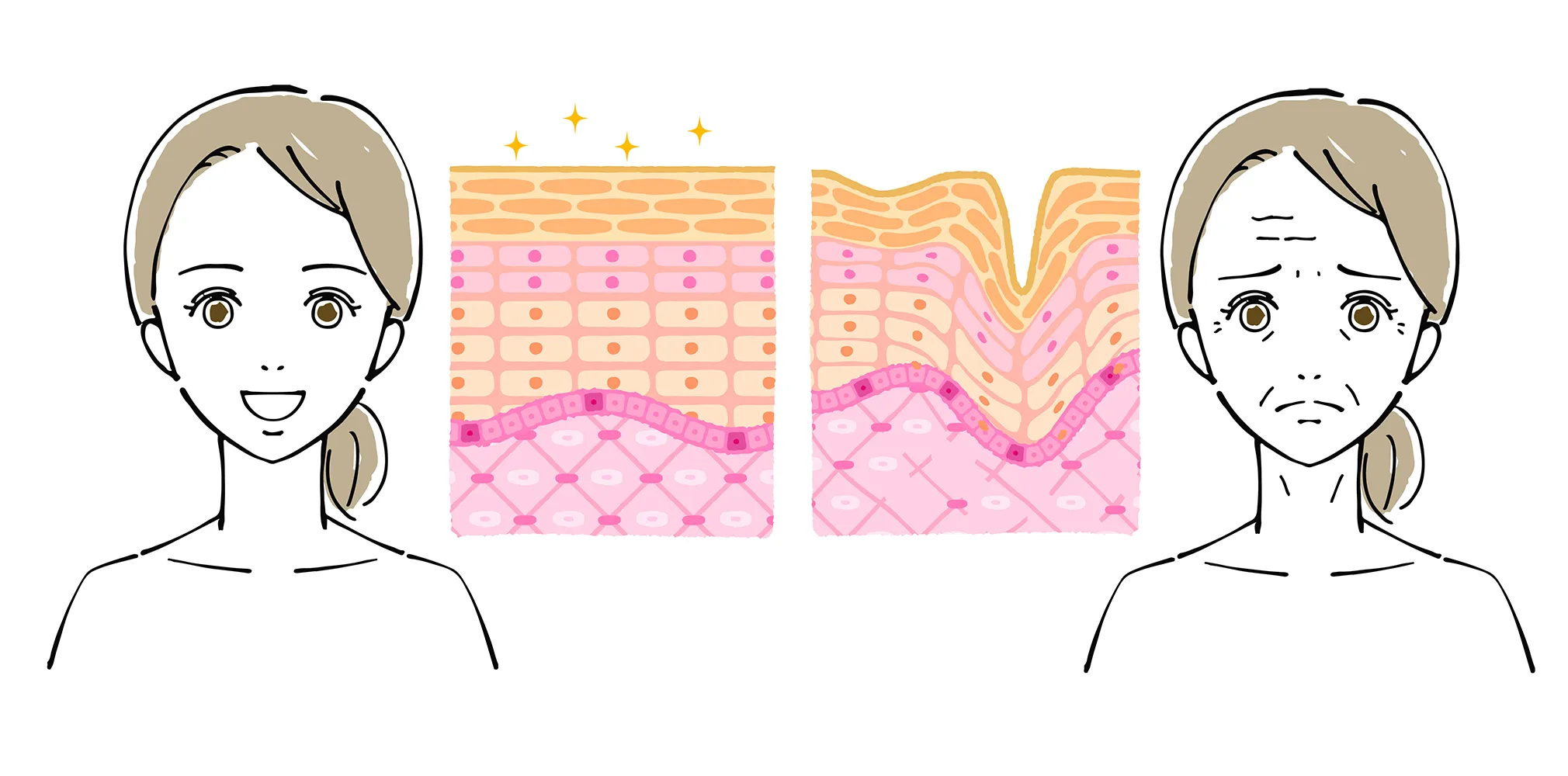 젊은 여성과 중년 여성의 얼굴 주름 비교
