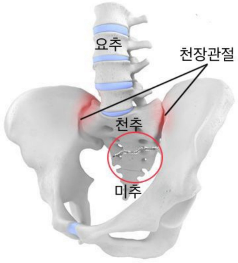 허리 요추와 골반, 천추 그리고 천장관절의 위치와 형태를 나타내주는 뼈 사진