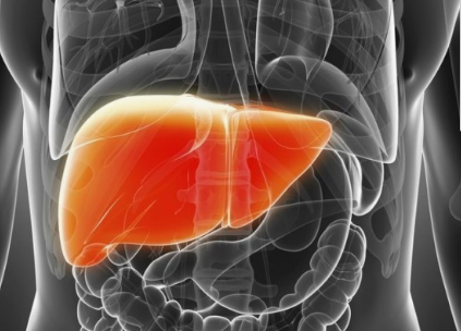 간부전 관련 이미지