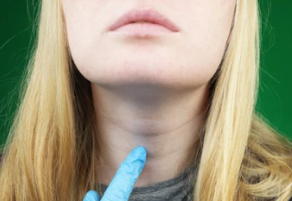 비인두암 초기증상