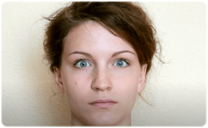 눈꺼풀 처짐 운동