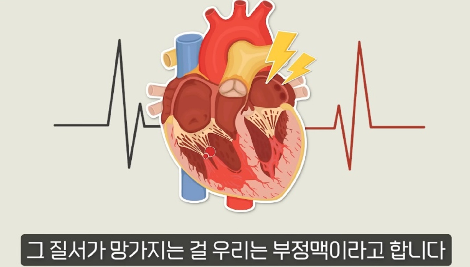 고혈압-명의-박성미-교수