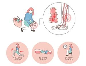 하지정맥류운동