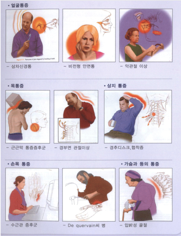 만성통증 증상 이미지