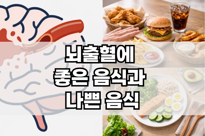뇌출혈에 좋은 음식과 나쁜 음식