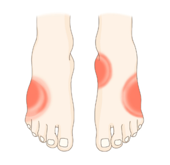 봉와직염의 합병증
