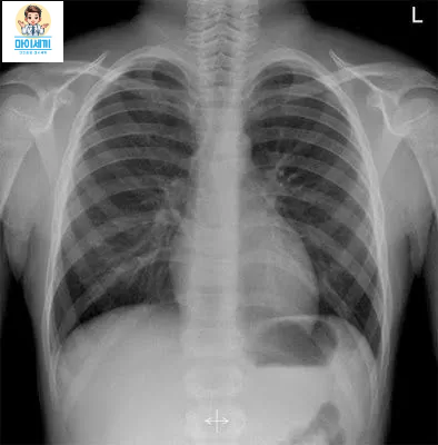 xray