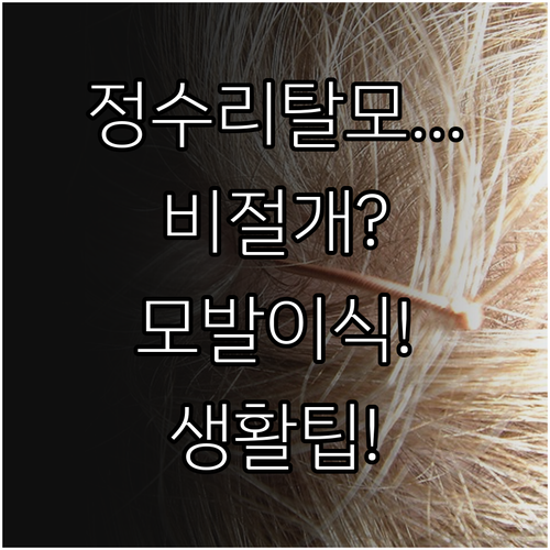 정수리 탈모 개선 비절개 모발이식 과..