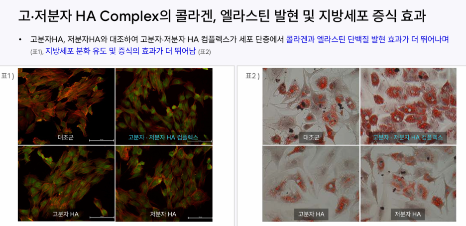 강남역 힐로웨이브 시술 효과
