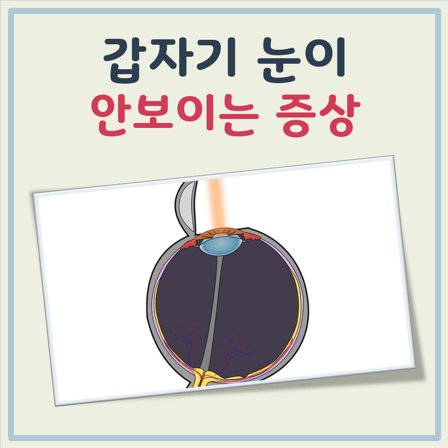 갑자기 눈이 안보이는 증상 대표 이미지