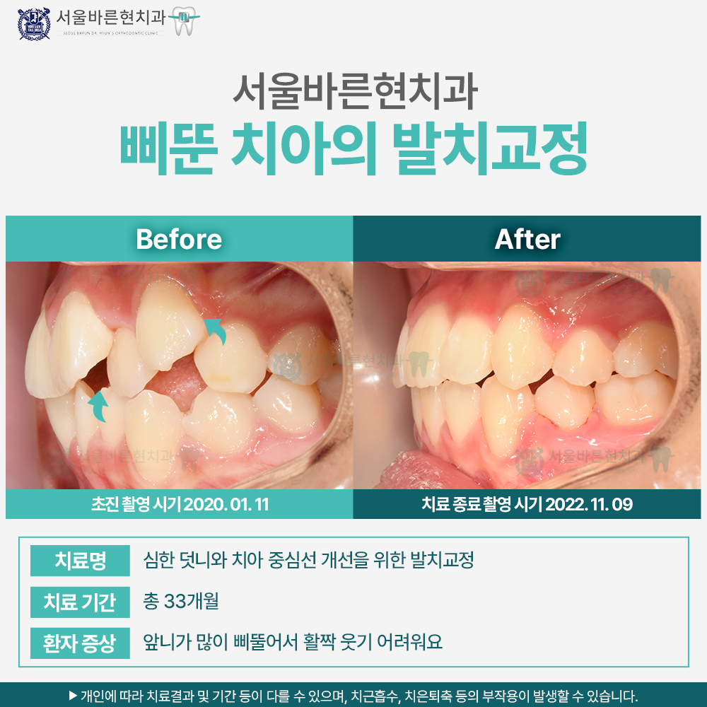 부산교정치과
