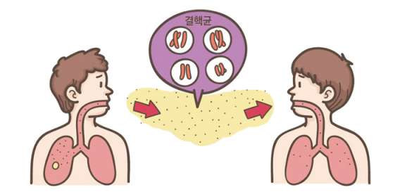 결핵 증상&amp;#44;원인