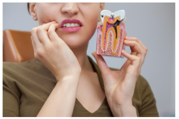 수면 임플란트 비용 과정