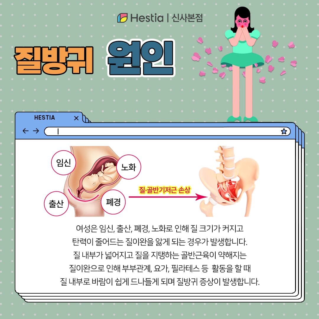 질방귀 질에서 바람빠지는 소리 원인은?