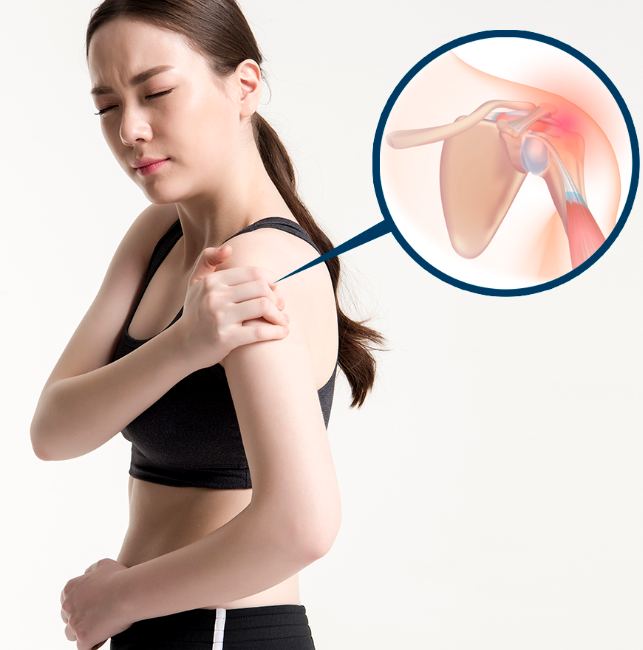 회전근개증후군의 주요증상