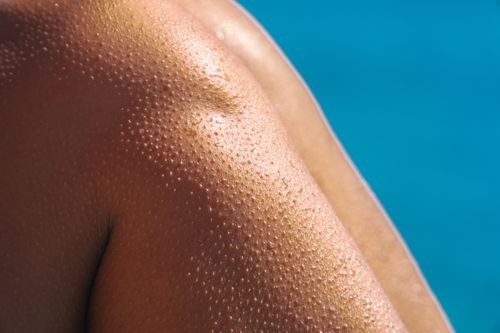 가을철 정전기 피부 가려움 줄이는 방법&amp;#44; 보습만으로 안 된다면 꼭 확인하세요