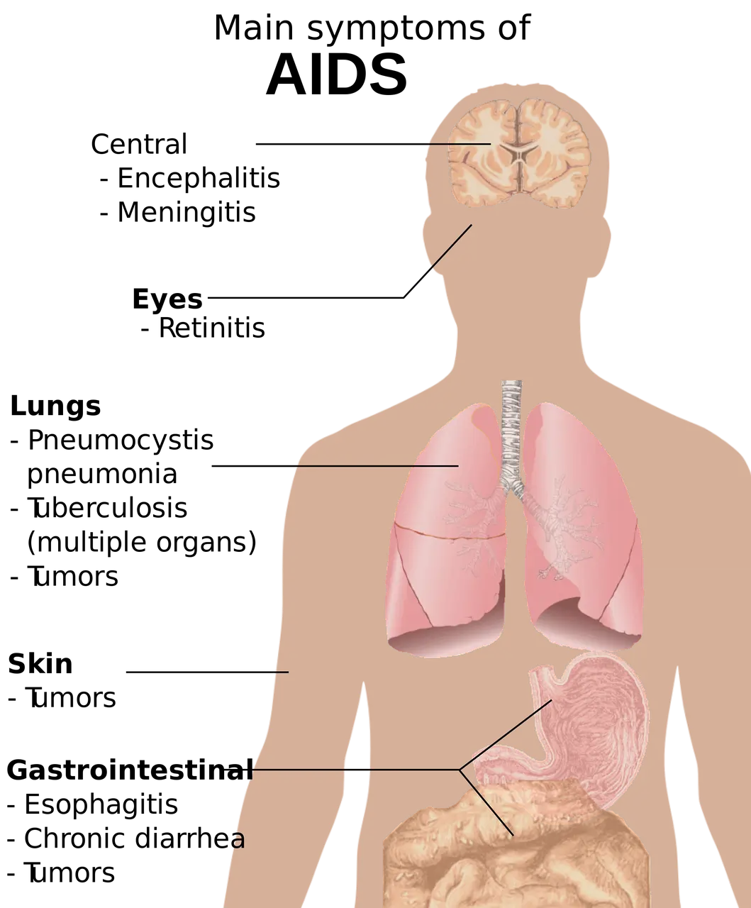 간 영양제 추천 