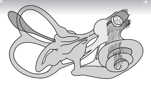 이석증 관련 사진