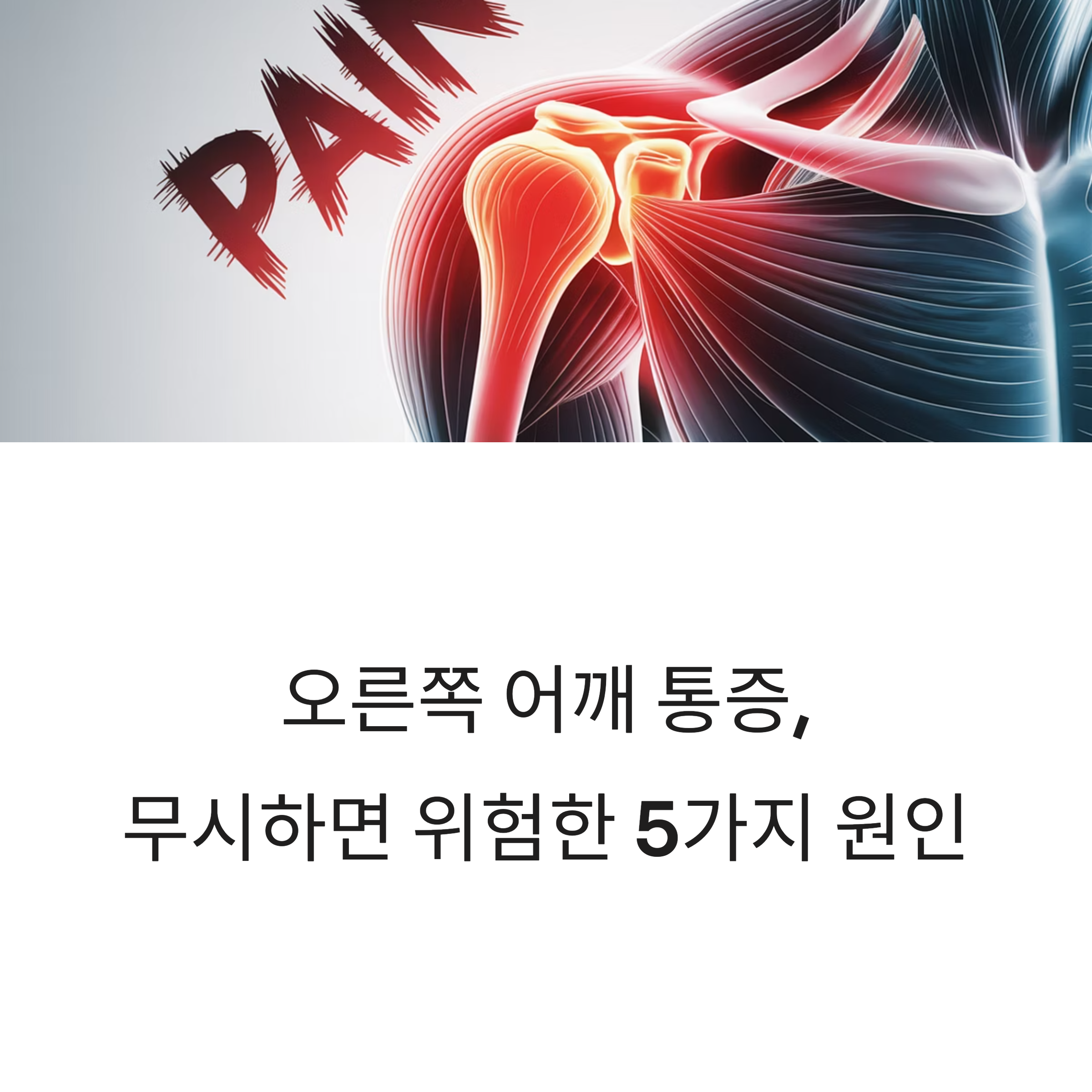오른쪽 어깨 통증의 주요 5가지 원인을 경고하는 근육 통증 관련 일러스트