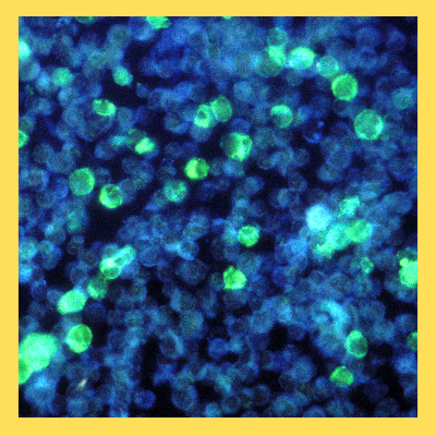 사람메타뉴모바이러스증상치료제