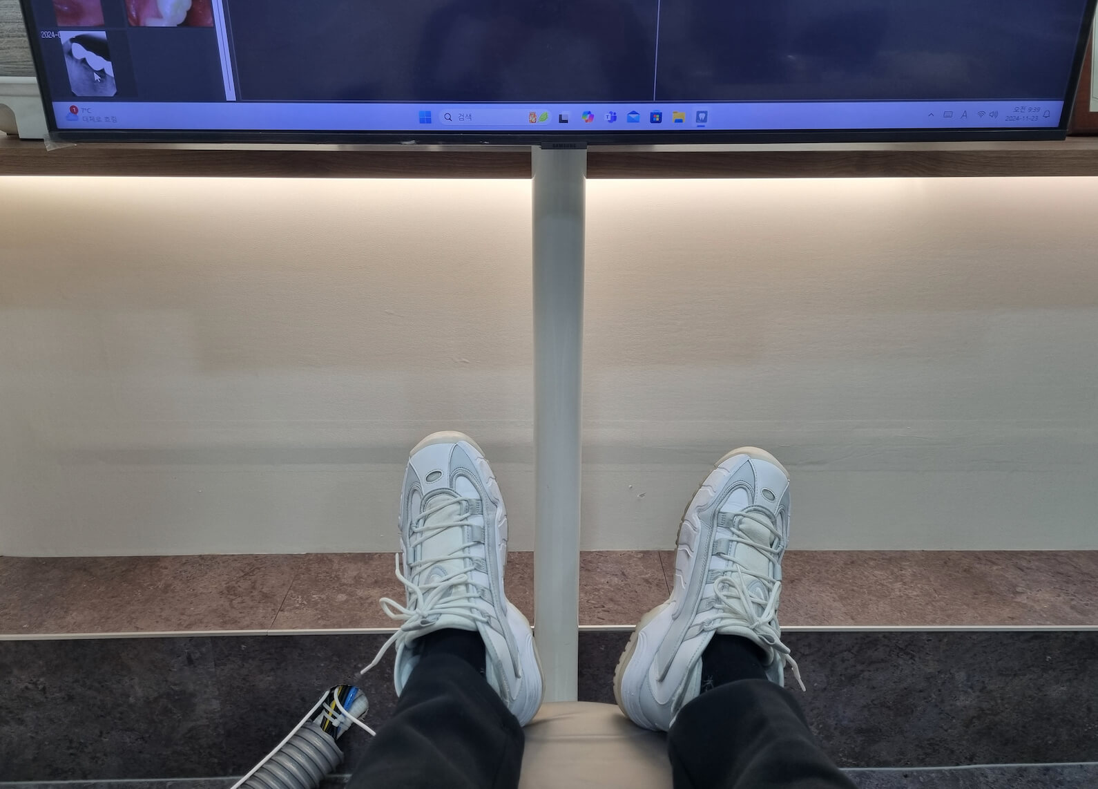 임플란트 크라운 깨짐