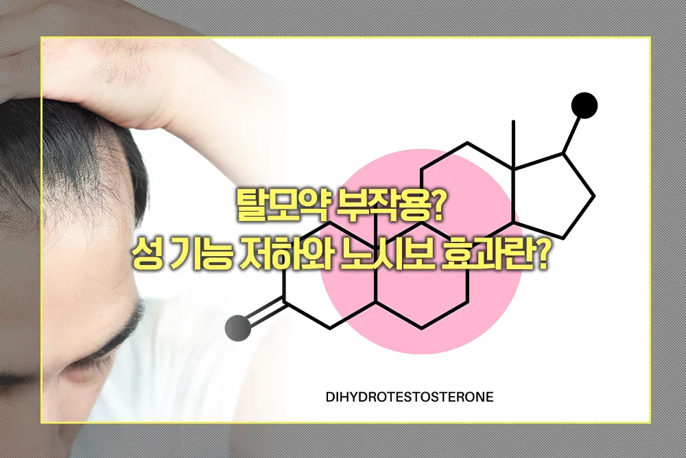 탈모약 부작용 성 기능 저하와 노시보 효과