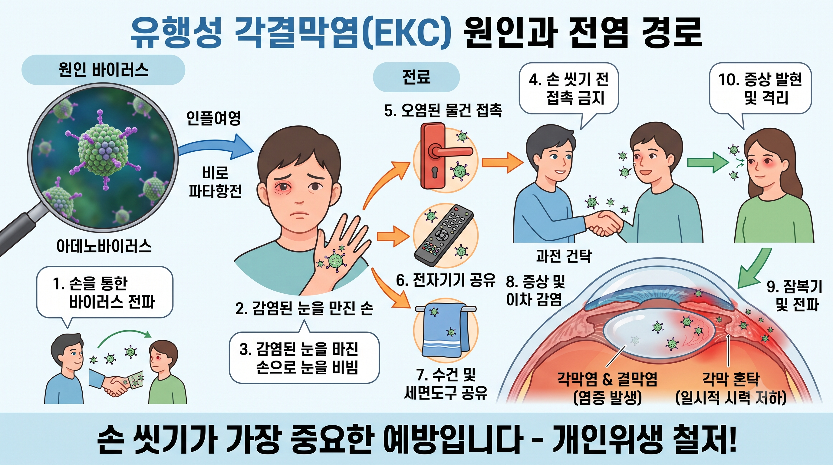 유행성 각결막염의 원인과 전염 경로