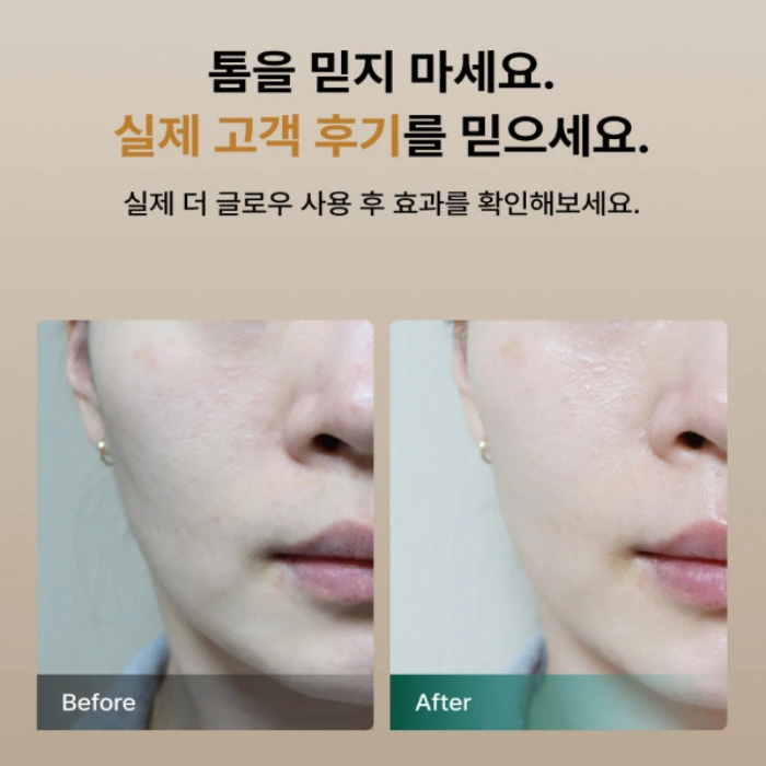 톰 더글로우 내돈내산 후기 가격 효과 부작용 사용 방법