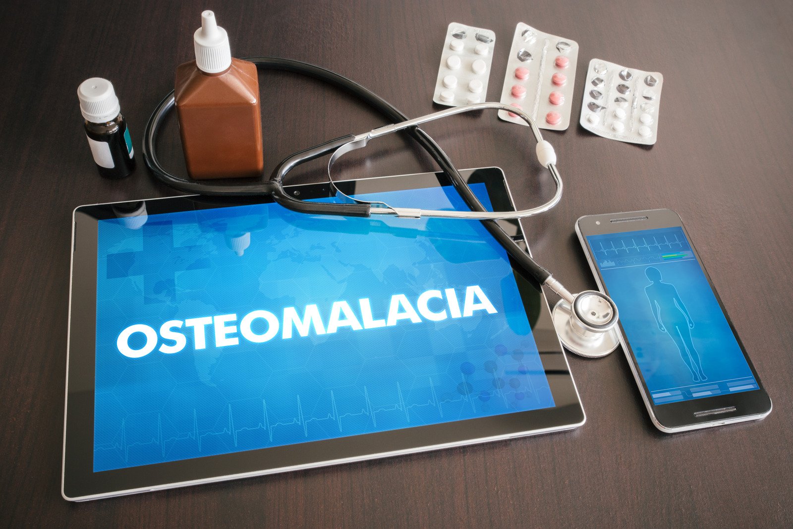 골연화증 [Osteomalacia]에 대한 이해