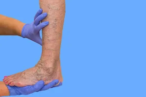 발목이-붓는-이유