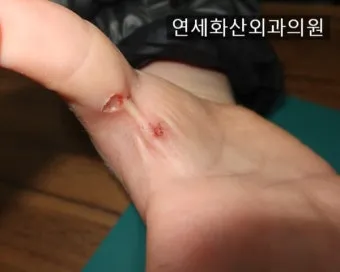 콘센트 스파크 해결법 손쉽게 점검하기 정리_6