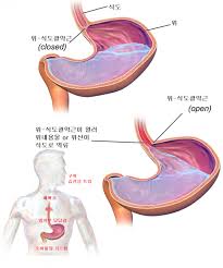 역류성 식도염 재발 이유&amp;#44; 약을 먹어도 계속 불편한 진짜 원인