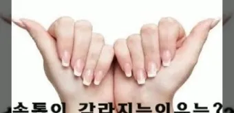 손톱이 갈라지는 이유 원인 증상 대처법_26