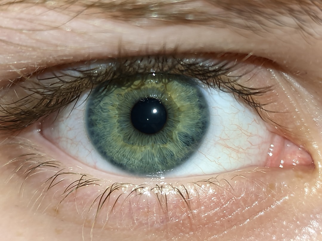 Eye disease