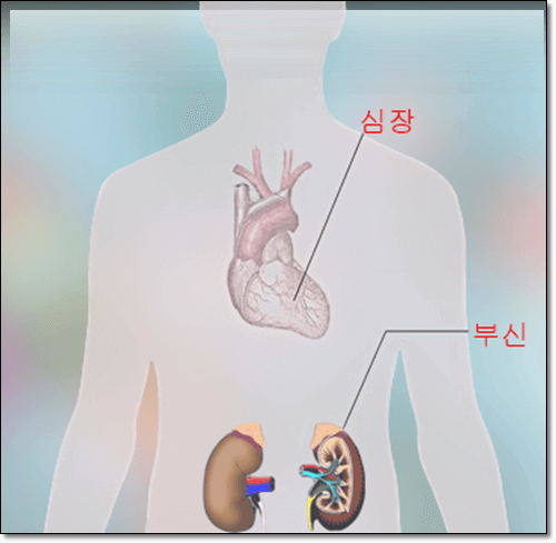 애디슨병 원인