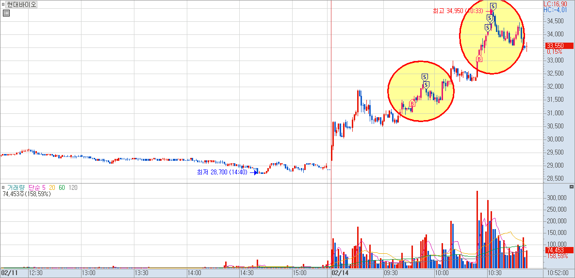 현대바이오 차트 예시 2)