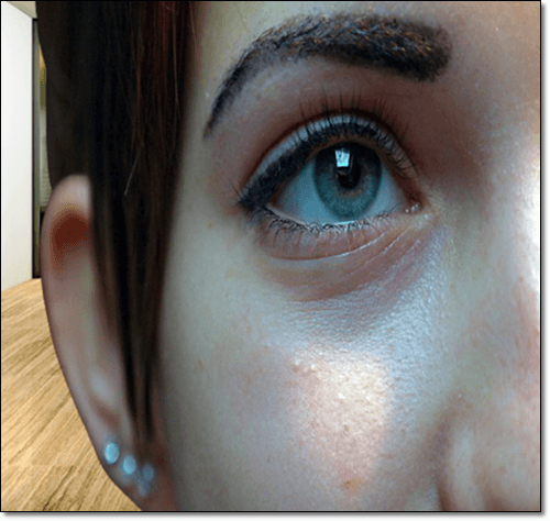 다래끼 초기 증상이 보이는 여성