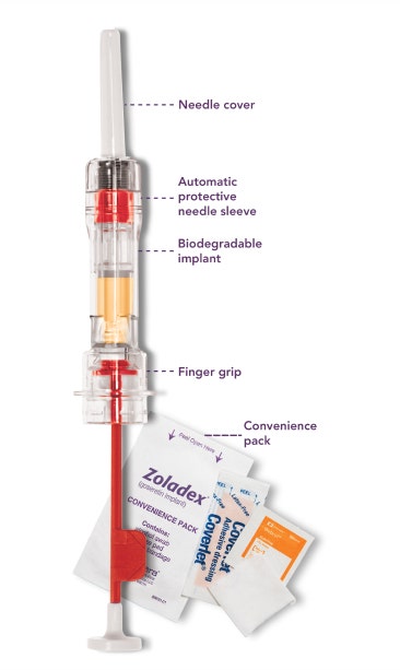 졸라덱스 주사 부작용 임신 비용 실비 데포주 바늘 탈모 유방암 전립선암 호르몬제 투여 기간 데포 자궁내막증 자궁근종 성호르몬 에스트로겐 테스토스테론