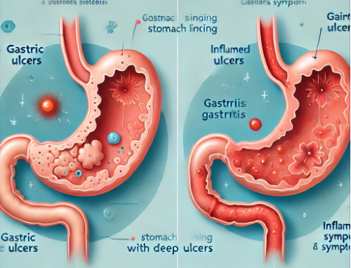 위궤양과 위염 차이