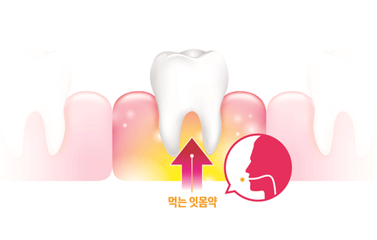 먹는 잇몸약 효능