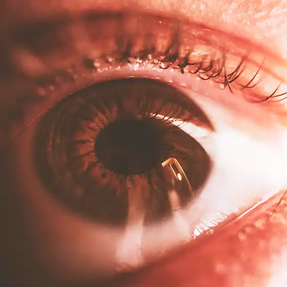 증상별 안약성분