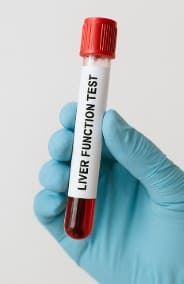 간기능검사를위한혈액