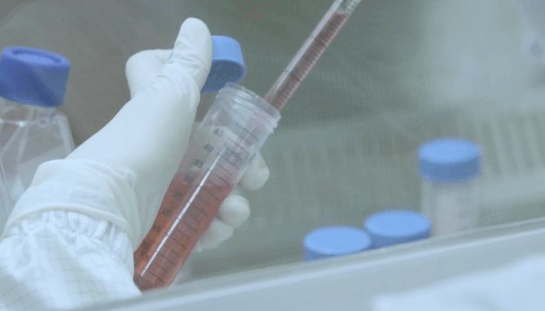 파미셀 주가 전망 줄기세포 실적발표 엠폭스 원숭이두창