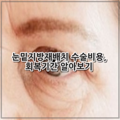 눈밑지방재배치 수술비용, 회복기간 알아보기