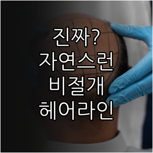 자연스러운 비절개 모발이식을 위한 헤..