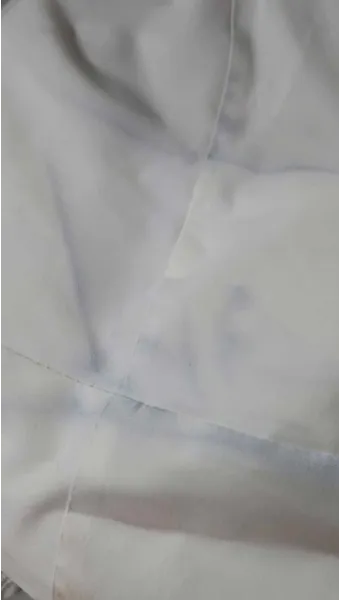 이염 제거 산소계표백제 테스트와 국소 세척 순서_19