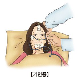 기면증진단